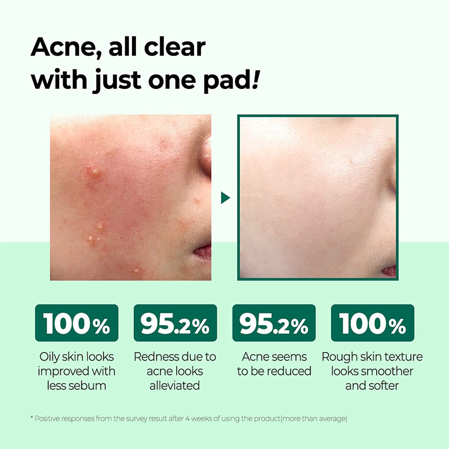 [SOMEBYMI] AHA BHA PHA 30 Days Miracle Truecica Clear Pad (70ea)