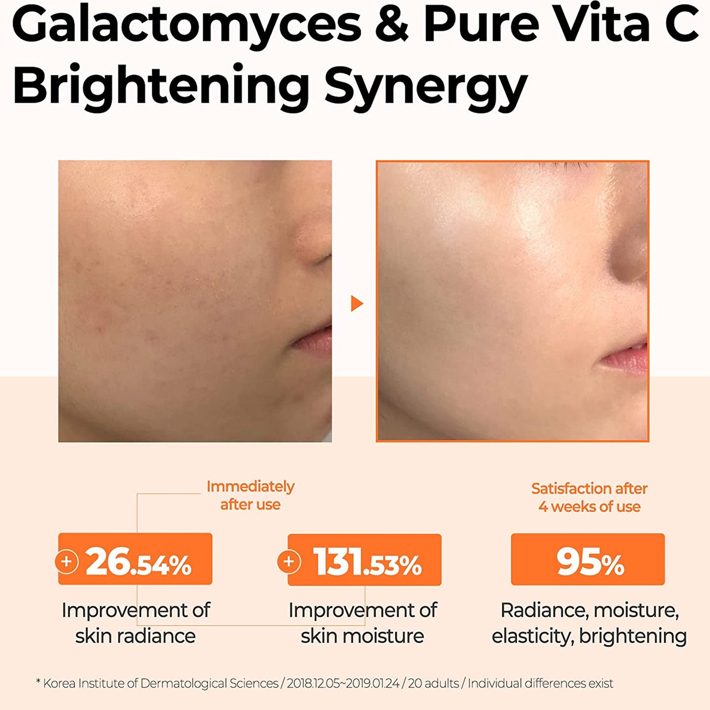 [SOMEBYMI] Galactomyces Pure Vitamin C Glow Toner 200ml